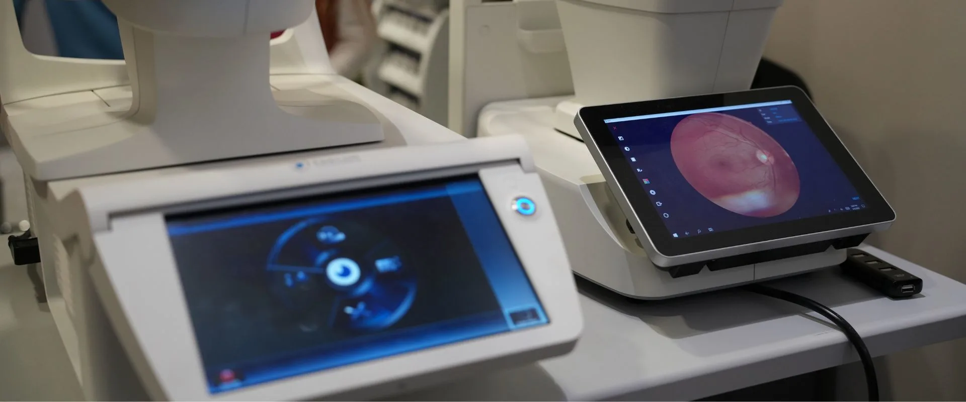 Fundus photography equipment displaying a detailed retinal image on the imaging screen at Reza Ferreira Boutique Optometrists